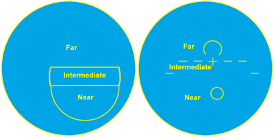 trifocals versus progressive lenses